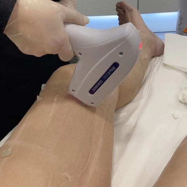 Diode Laser Therapy Device